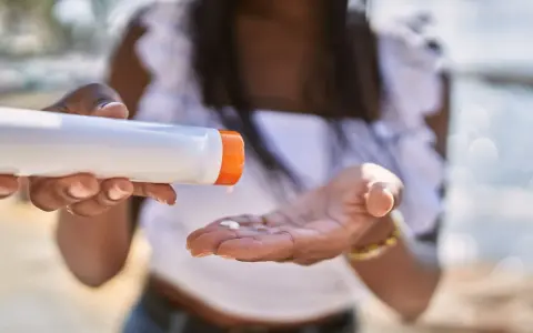 Frau gibt Sonnencreme auf ihre Hand. So vermeidet sie Sonnencreme Flecken auf Kleidung.